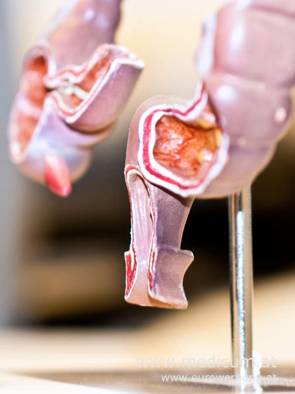 Erkrankungen des Enddarms